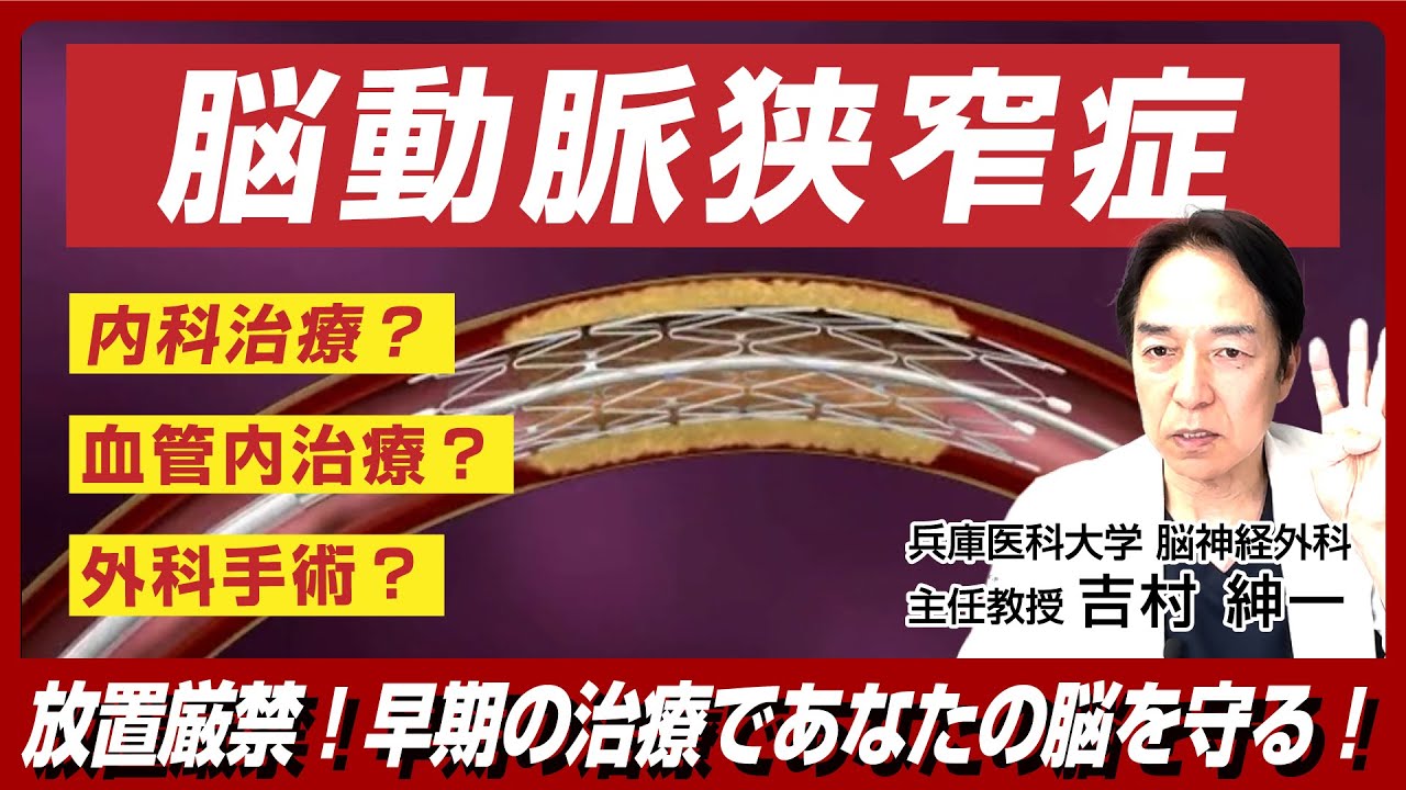 脳動脈狭窄症とは？手術や血管内治療より内服治療の方が予後が良い！？脳外科が解説！