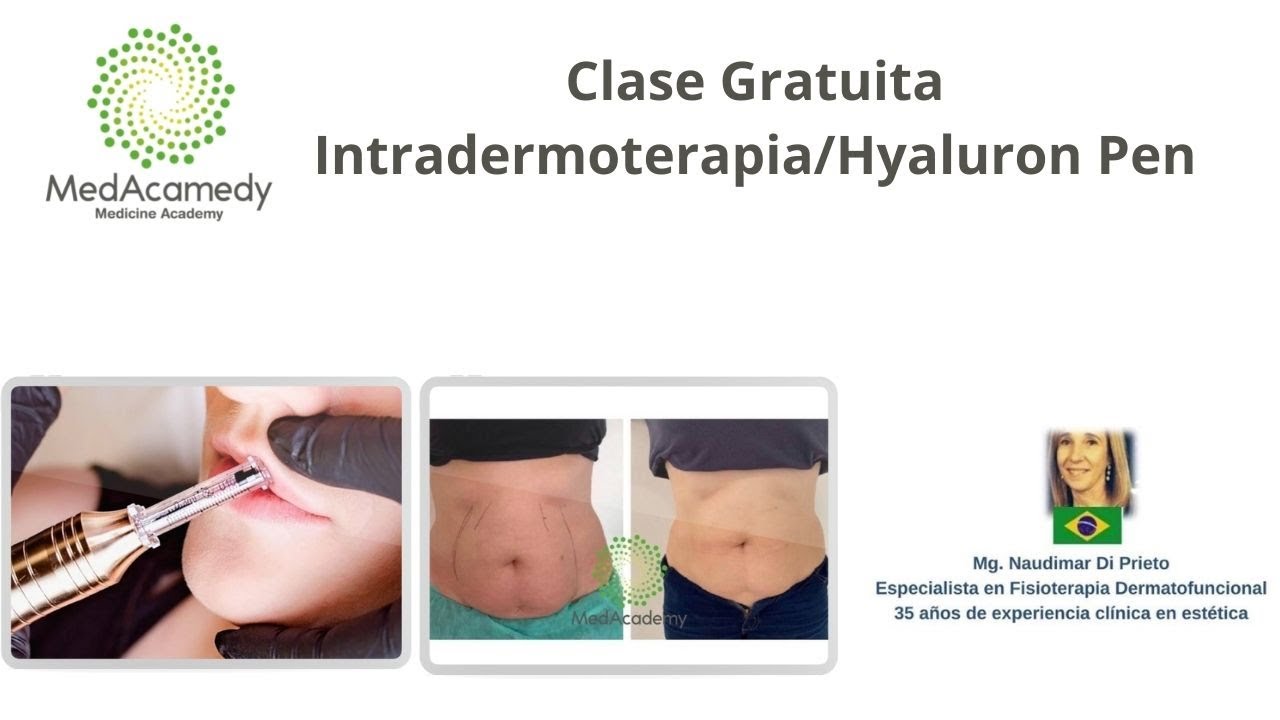 Charla Gratuita: Intradermoterapia presurizada/Hyaluron Pen