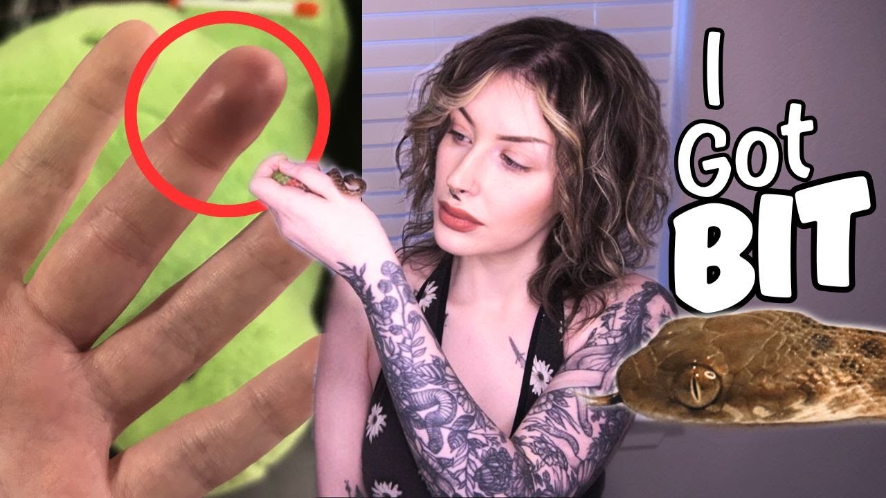 My Snake Bit Me and Gave Me Nerve Damage (Malagasy Cat Eyed Snake Bite)