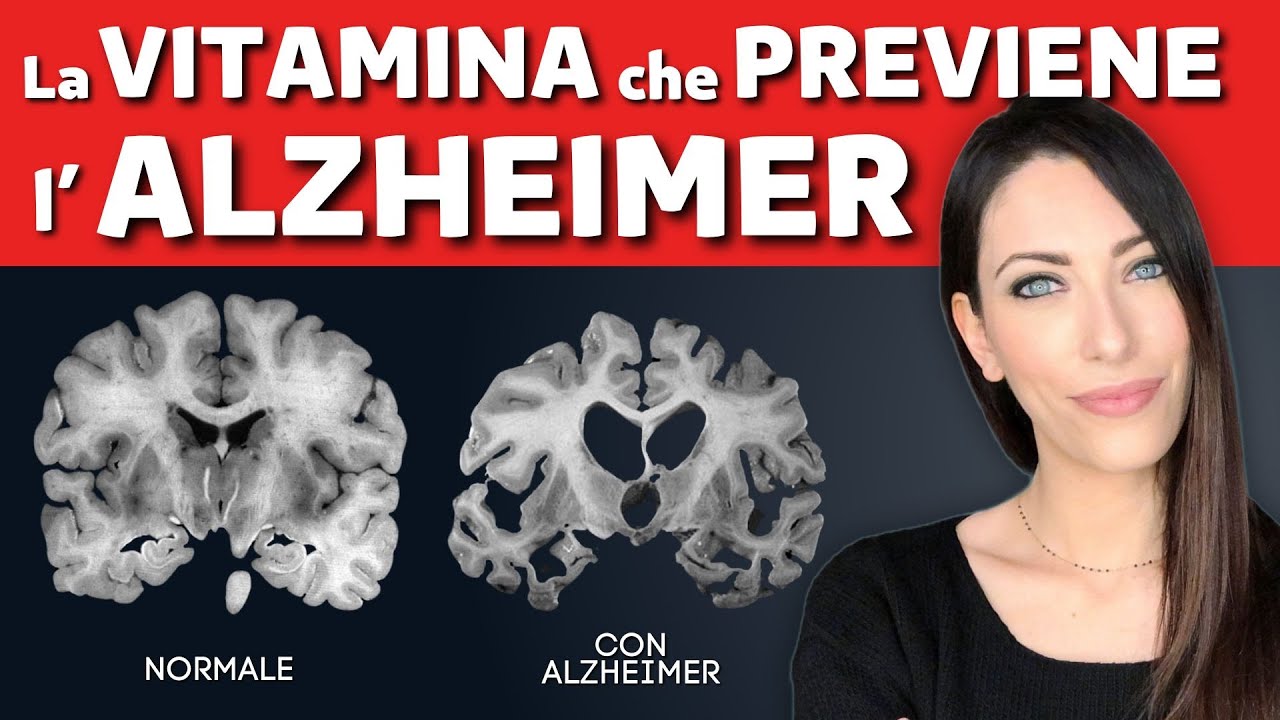 La VITAMINA che protegge dall'Alzheimer