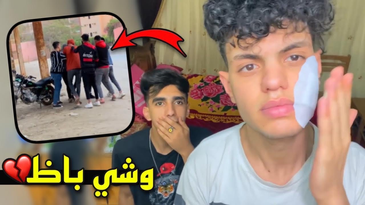 ابو الواد خد حقو مني وعورني في وشي (مش هتصدقو اللي حصل!!) 😱💔 | حامد سوستا