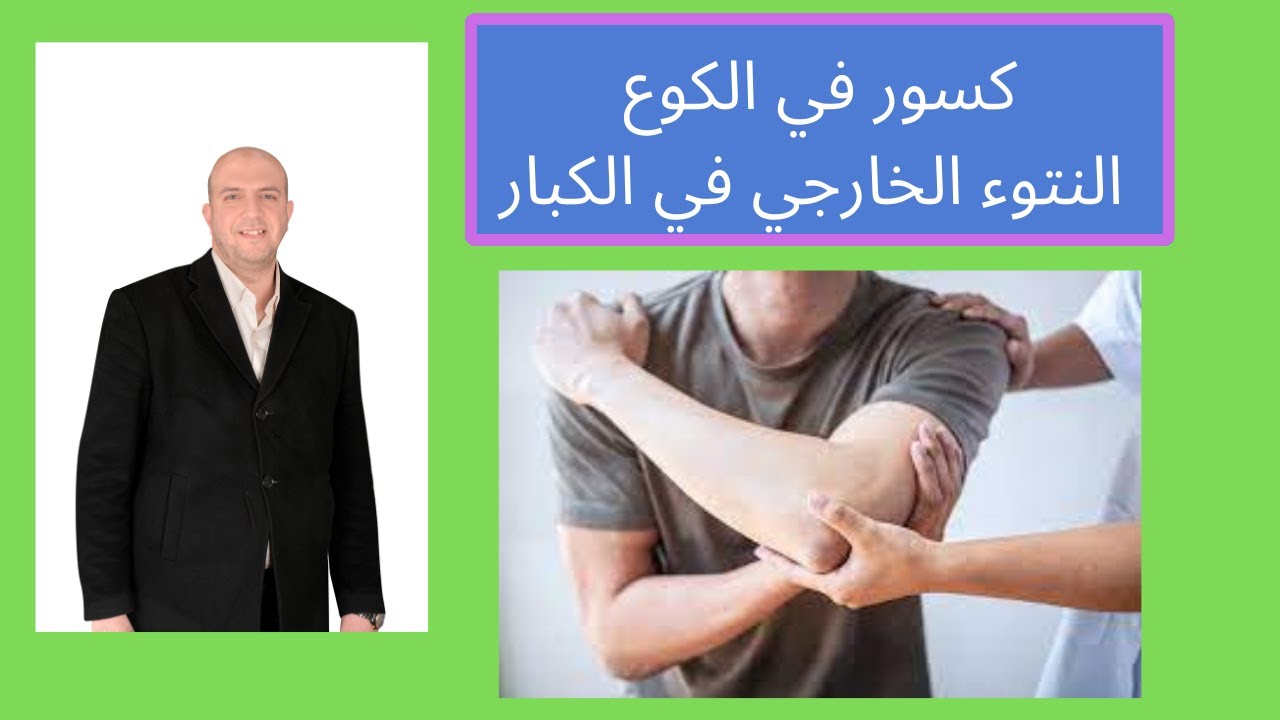 كسور في الكوع - النتوء الخارجي في الكبار للدكتور احمد العطار