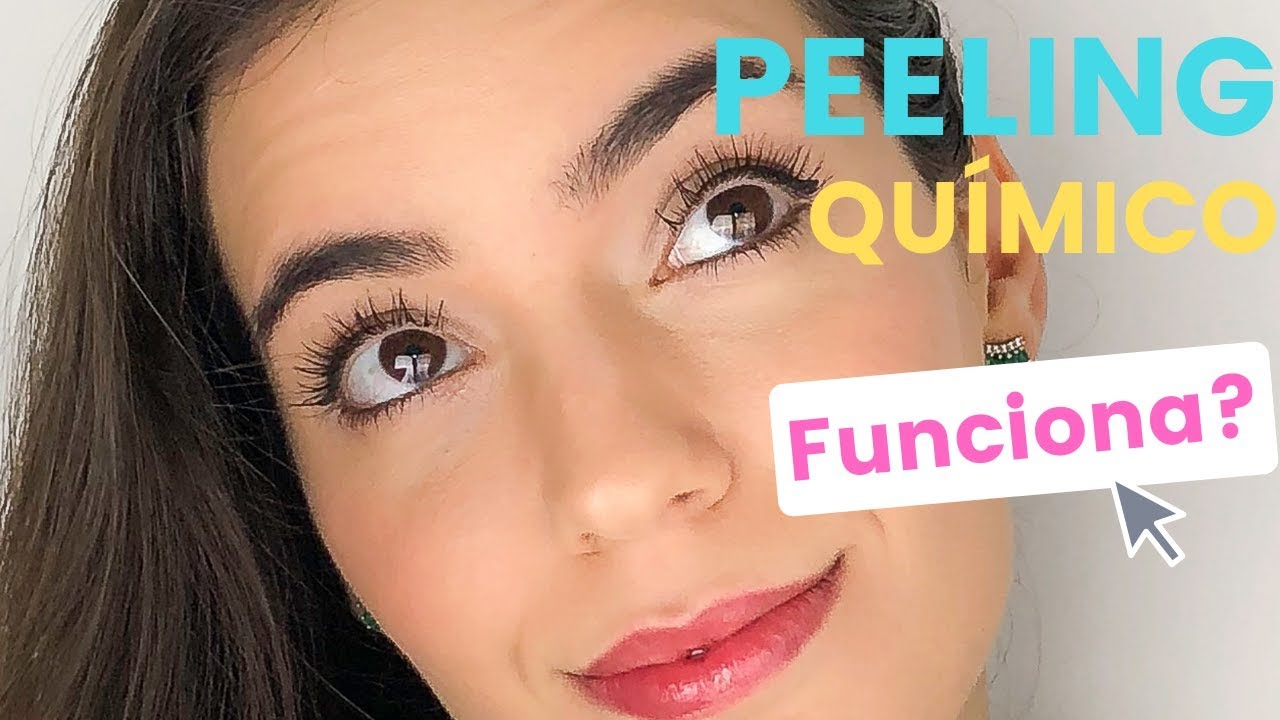 Peeling Químico - Trago Verdades!!!