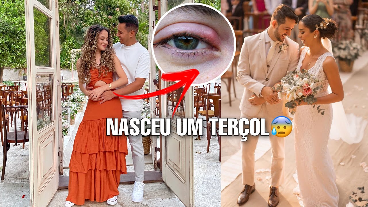 ARRUME-SE COMIGO COM TERÇOL NO OLHO | Casamento da @JulianaLouise
