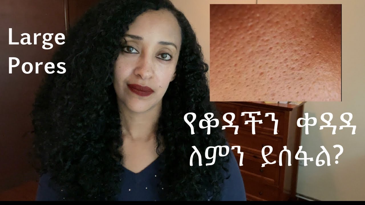 የፊታችን ቆዳ ቀዳዳ ለምን ይሰፋል? Why do we have large pores?