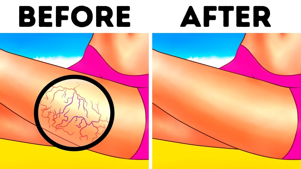 If You Have Poor Circulation, Here's How To Solve It