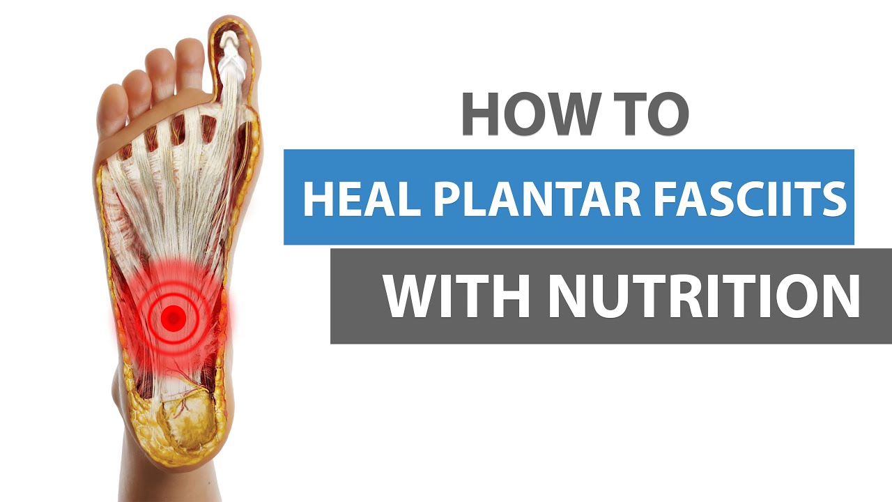 How To Expedite Plantar Fasciitis? Healing With Nutrition