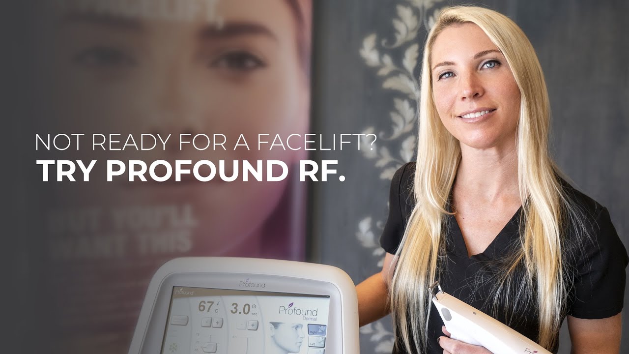 Non-Surgical Facelift Explained: Profound - Microneedling with Radiofrequency