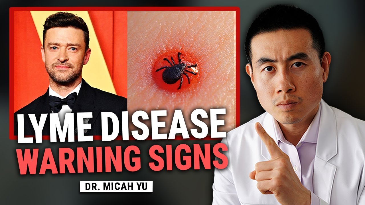 Dangerous Signs and Symptoms of Lyme Disease from a Tick Bite