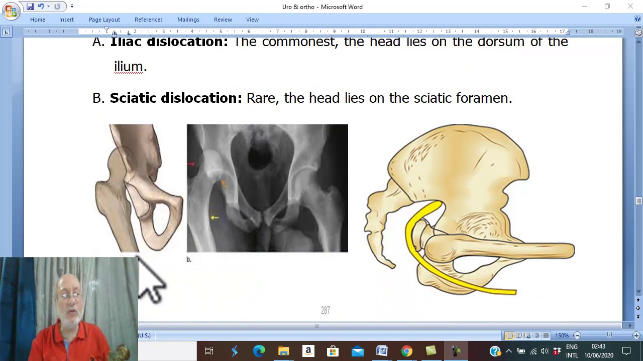 Orthopedic in Arabic 31 ( Dislocation of hip joint , part 1 ) , by Dr. Wahdan