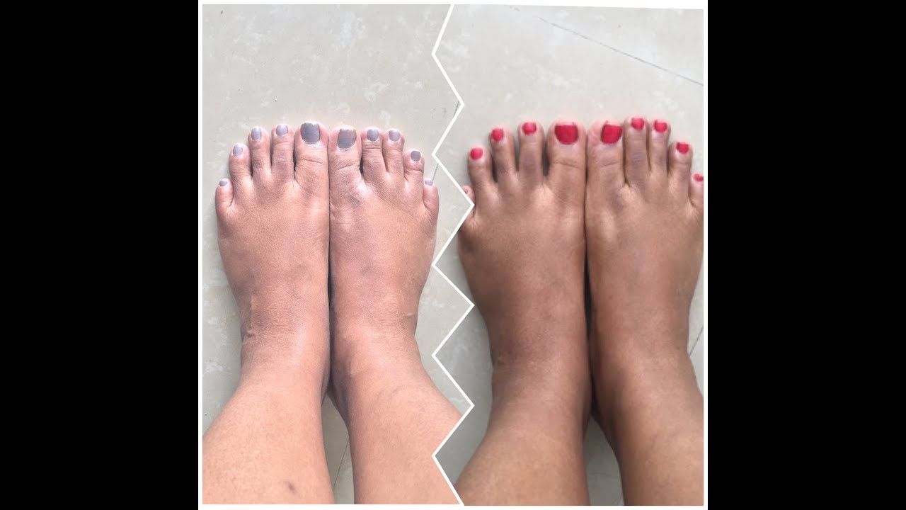 Easy and simple pedicure at home || How to do simple pedicure at home in Telugu:)