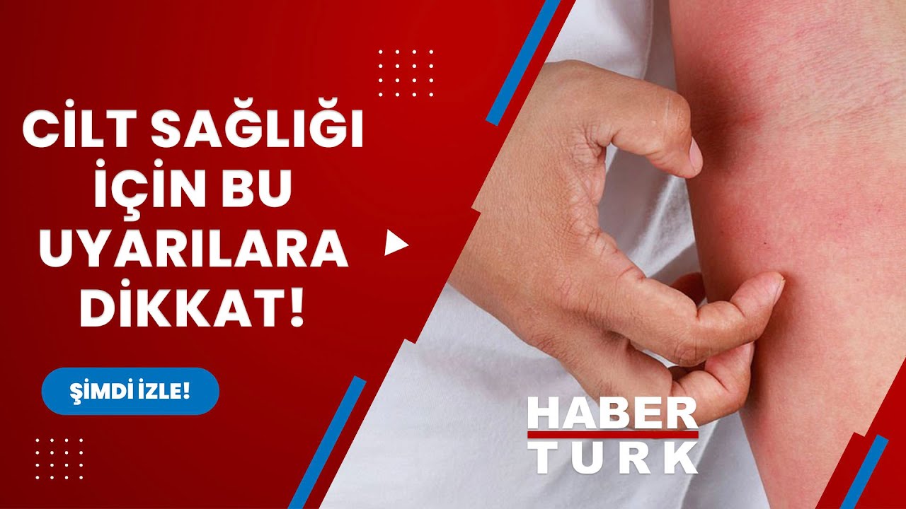 Cilt sağlığı için bu uyarılara dikkat! 'İsilik mantara dönüşebilir'