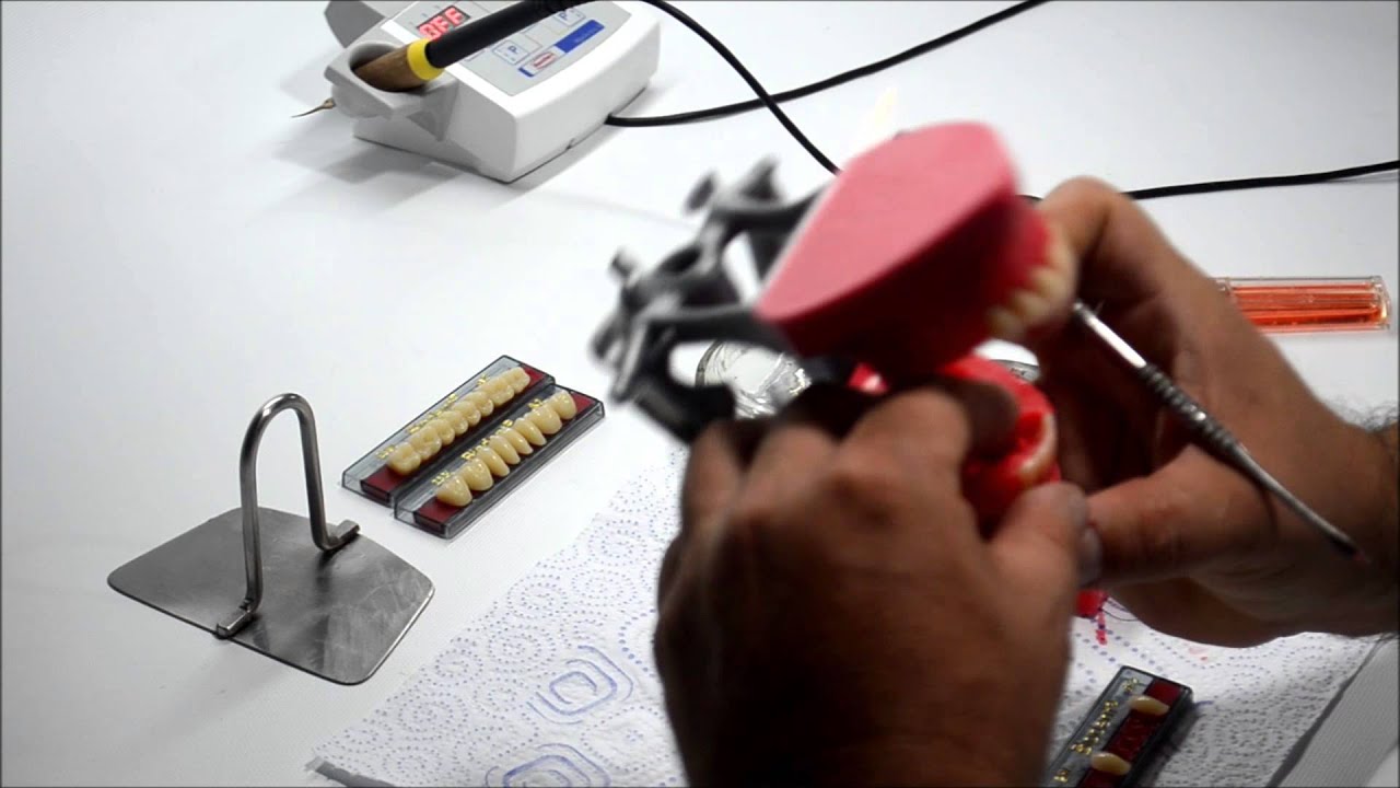 Montaje de dientes anteriores inferiores en prótesis total