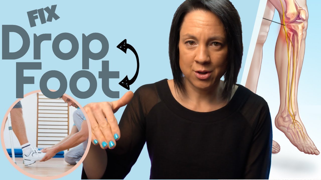 Best exercises for foot drop (drop foot)