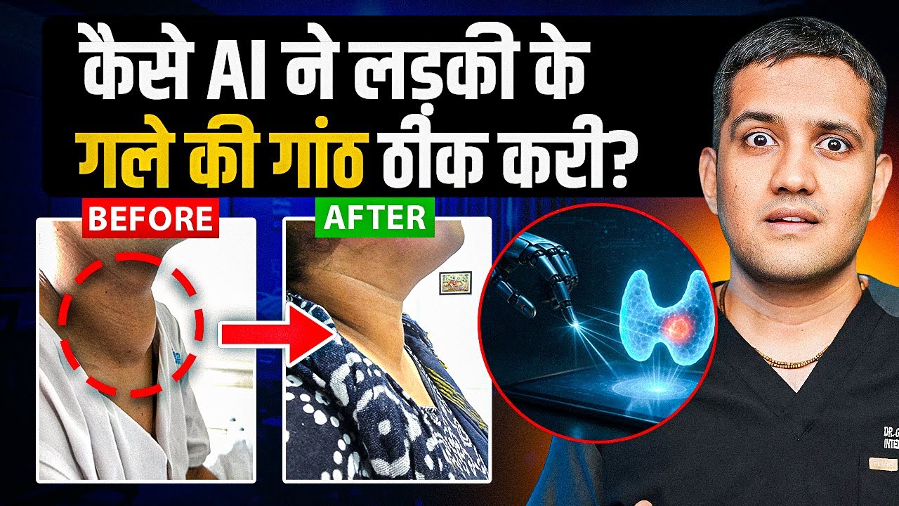 गले की गांठ बिना दर्द और सर्जरी के खत्म | Thyroid Treatment Without Surgery