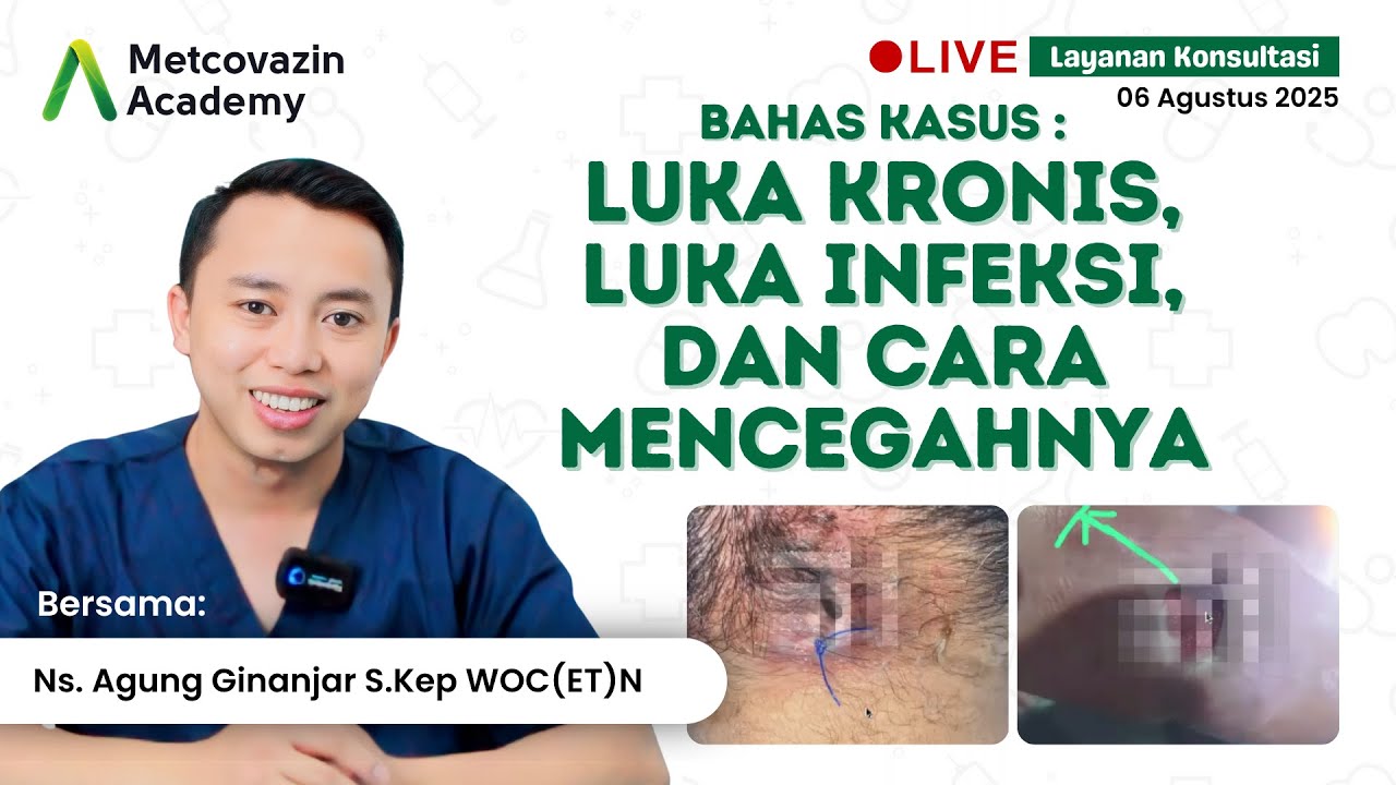 🔴LIVE RECORD | Kita Bahas Luka Infeksi dan Cara Mencegahnya