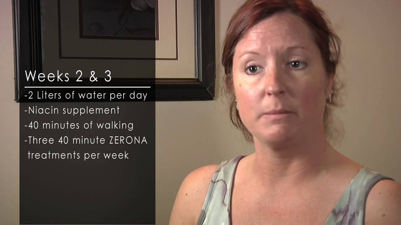 Zerona Laser Pain Free liposuction