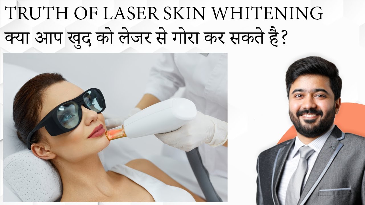 Truth Of Laser Skin Whitening | क्या आप खुद को लेजर से गोरा कर सकते है। By Dr Shuken Dashore Indore