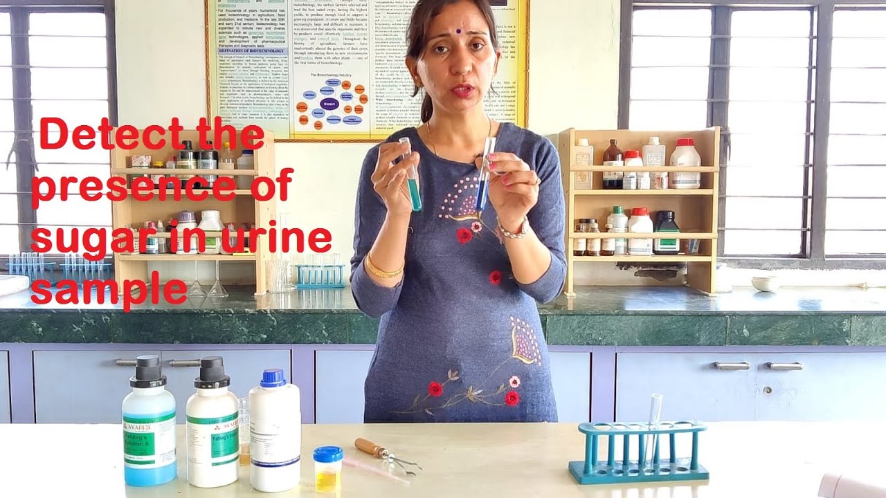 TO DETECT THE PRESENCE OF SUGAR IN URINE SAMPLE