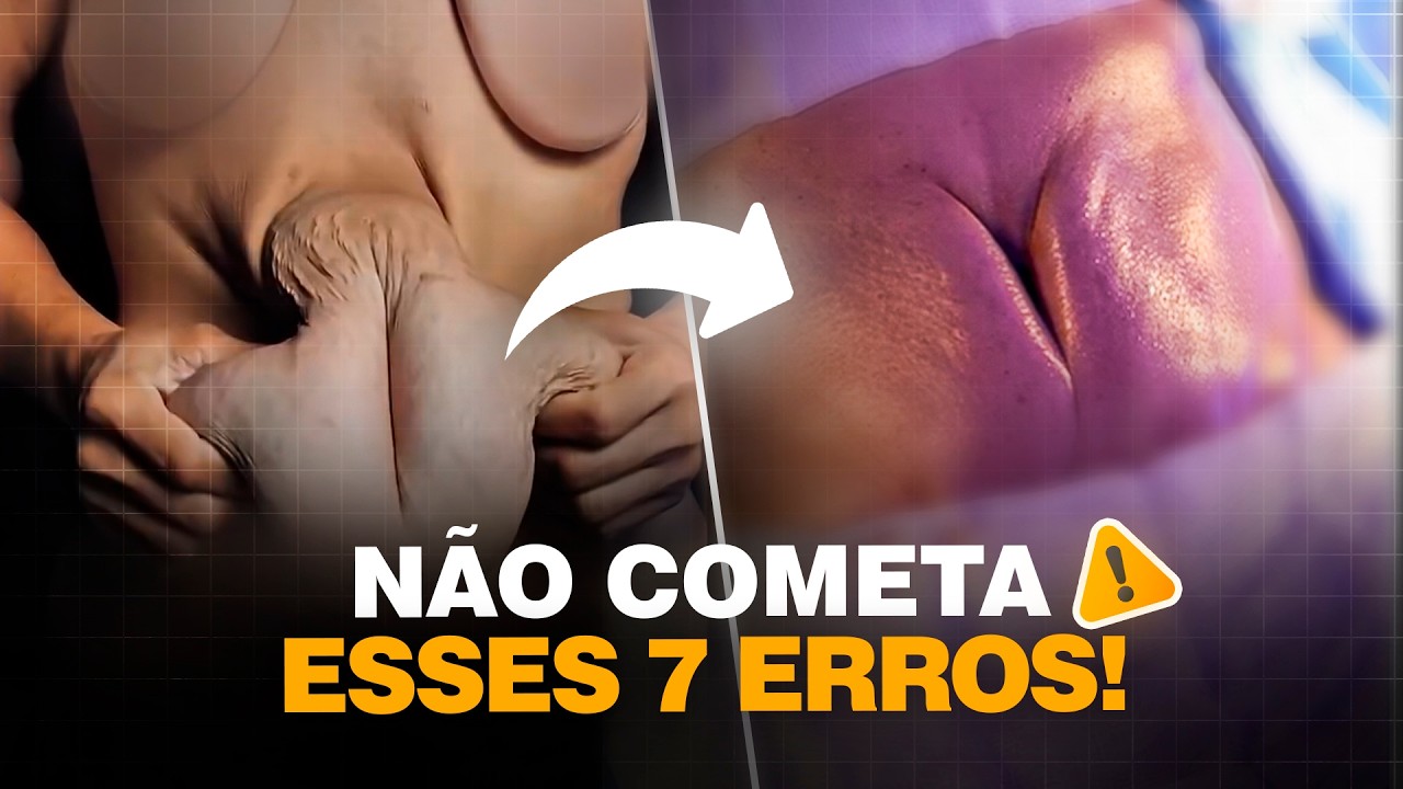 ABDOMINOPLASTIA Os 7 Erros Que Mais Estragam o Resultado (E Como Evitar Todos!) | Dr. Ícaro Samuel