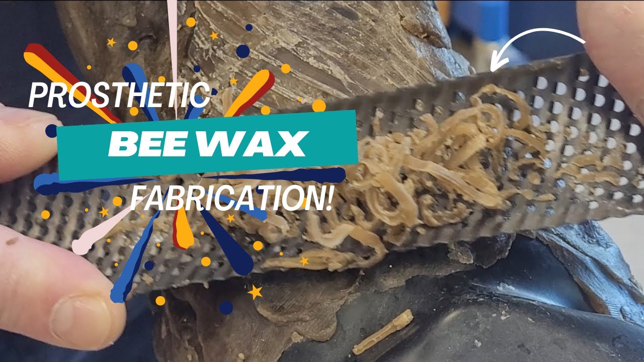 Trans-radial Wax Shaping Technique!