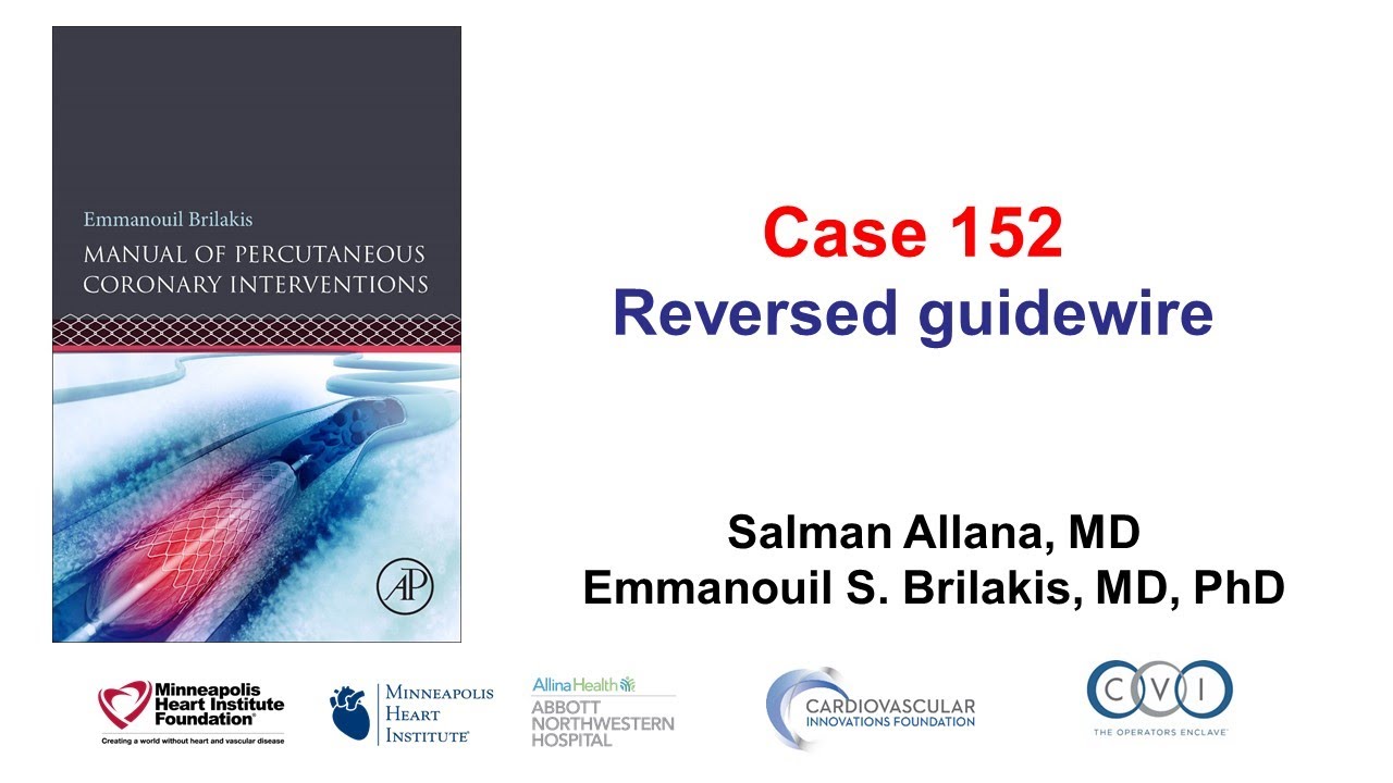 Case 152: PCI Manual - Reversed guidewire