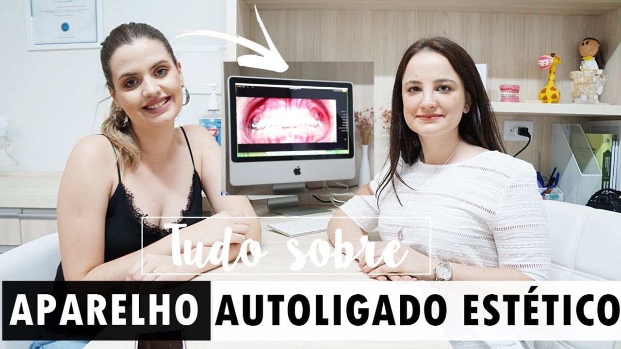 TUDO SOBRE O MEU APARELHO AUTOLIGADO ESTÉTICO