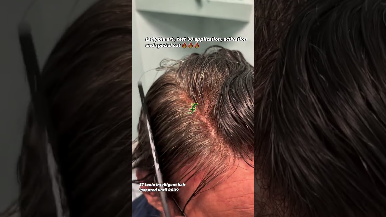 Alopecia: I Capelli Intelligenti 3T Ionix con Membrana del Gecko