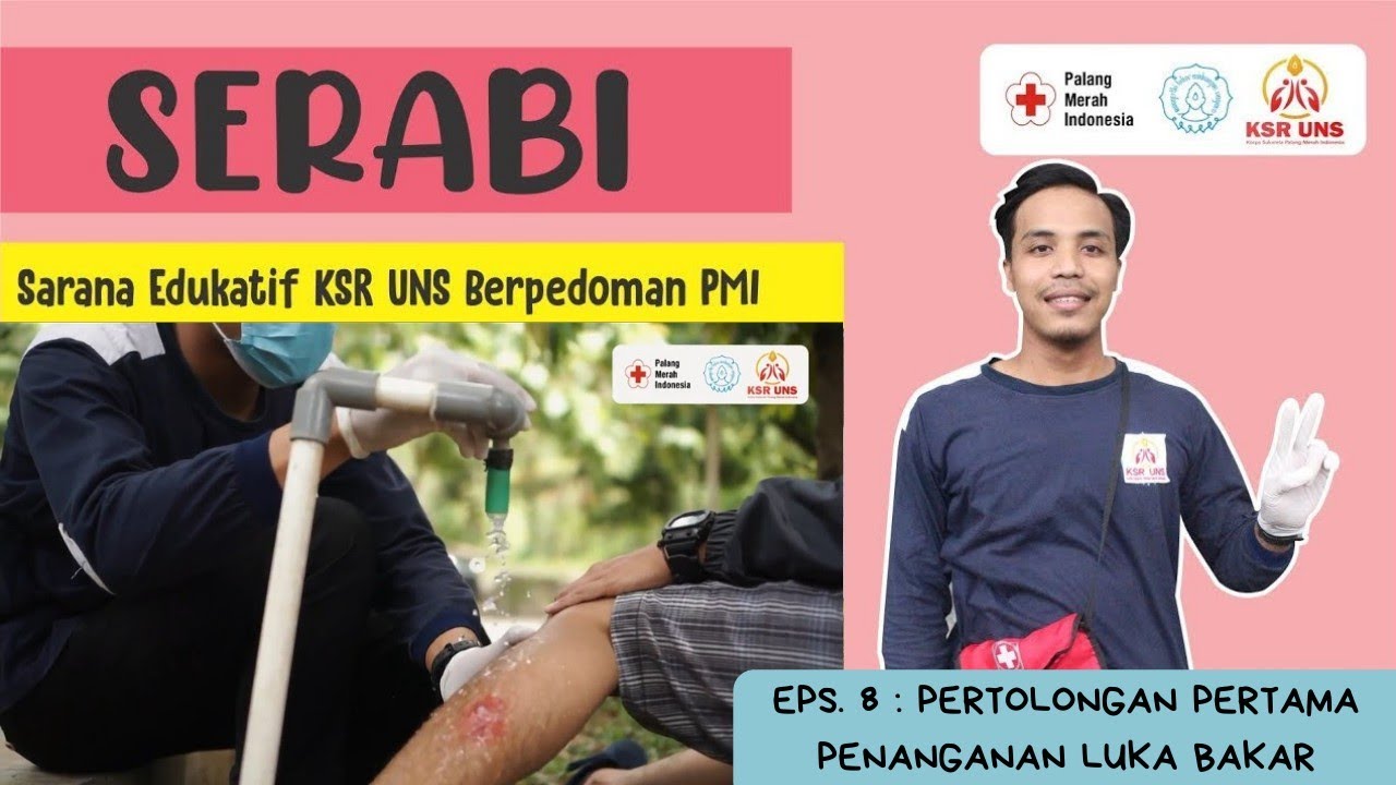 Serabi Eps. 8 : Pertolongan Pertama Penanganan Luka Bakar
