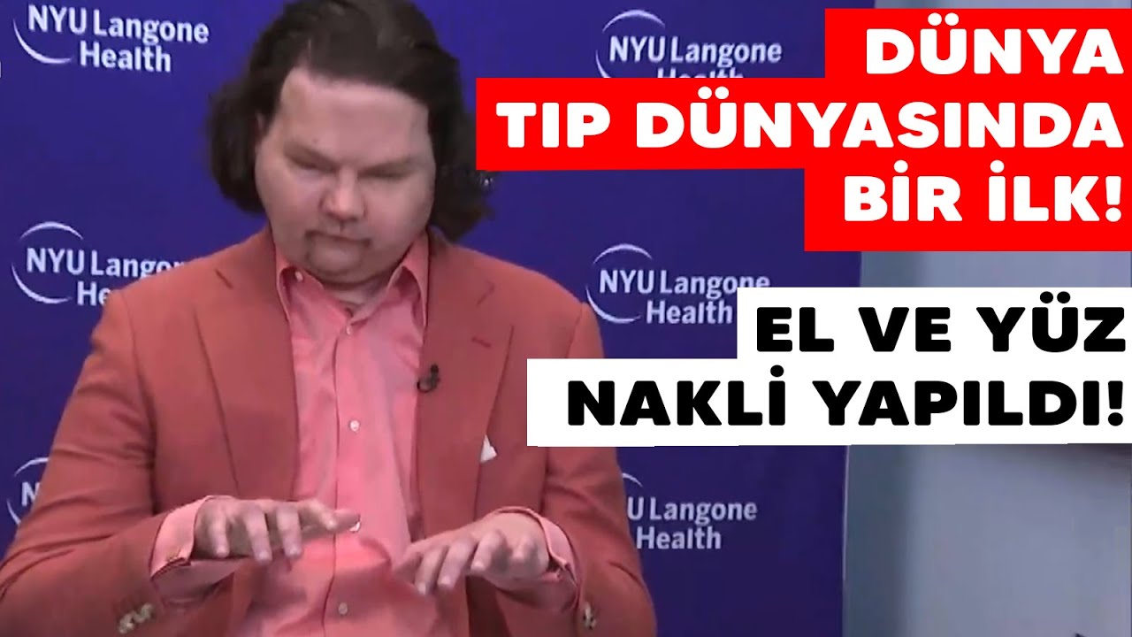 Bunun adı mucize! Dünyanın ilk eş zamanlı çift el ve yüz nakli gerçekleştirildi