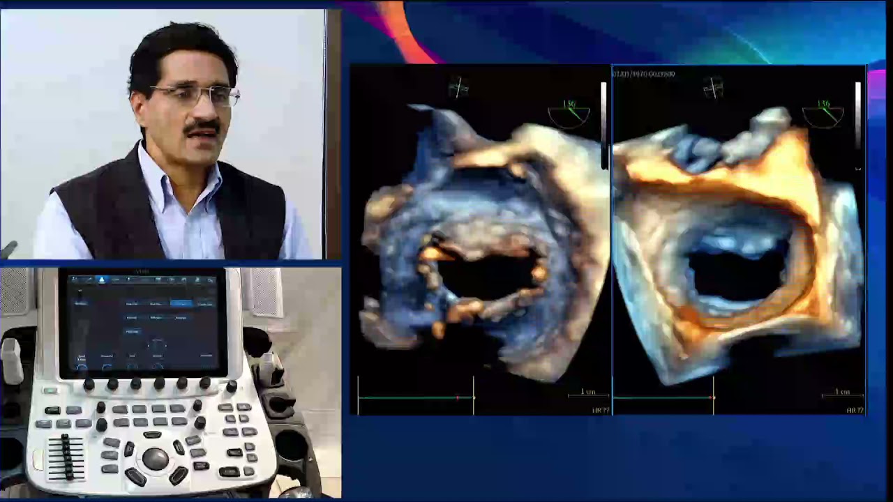 Vivid Talks - Demystifying the Heart with Dr. Naman Shastri || Volume 1