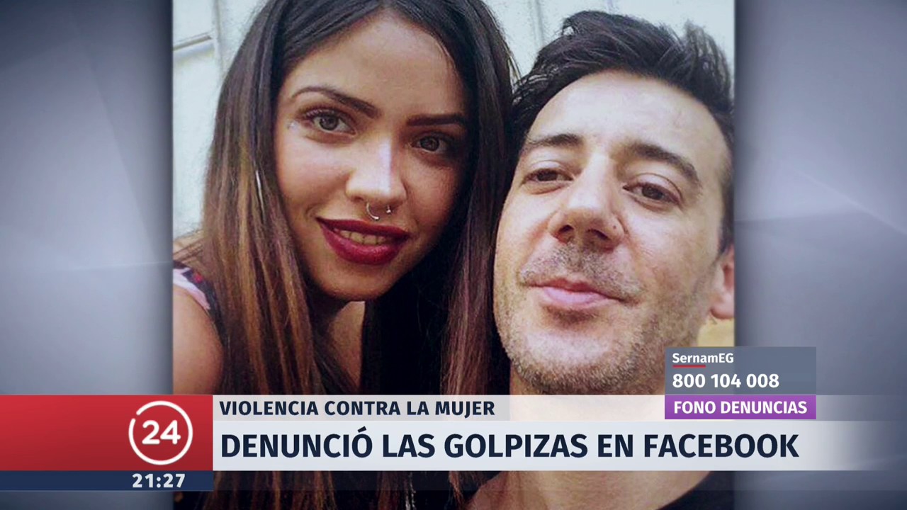 Denuncia contra vocalista de Los Tetas: Ex pareja entrega detalles de violentas agresiones