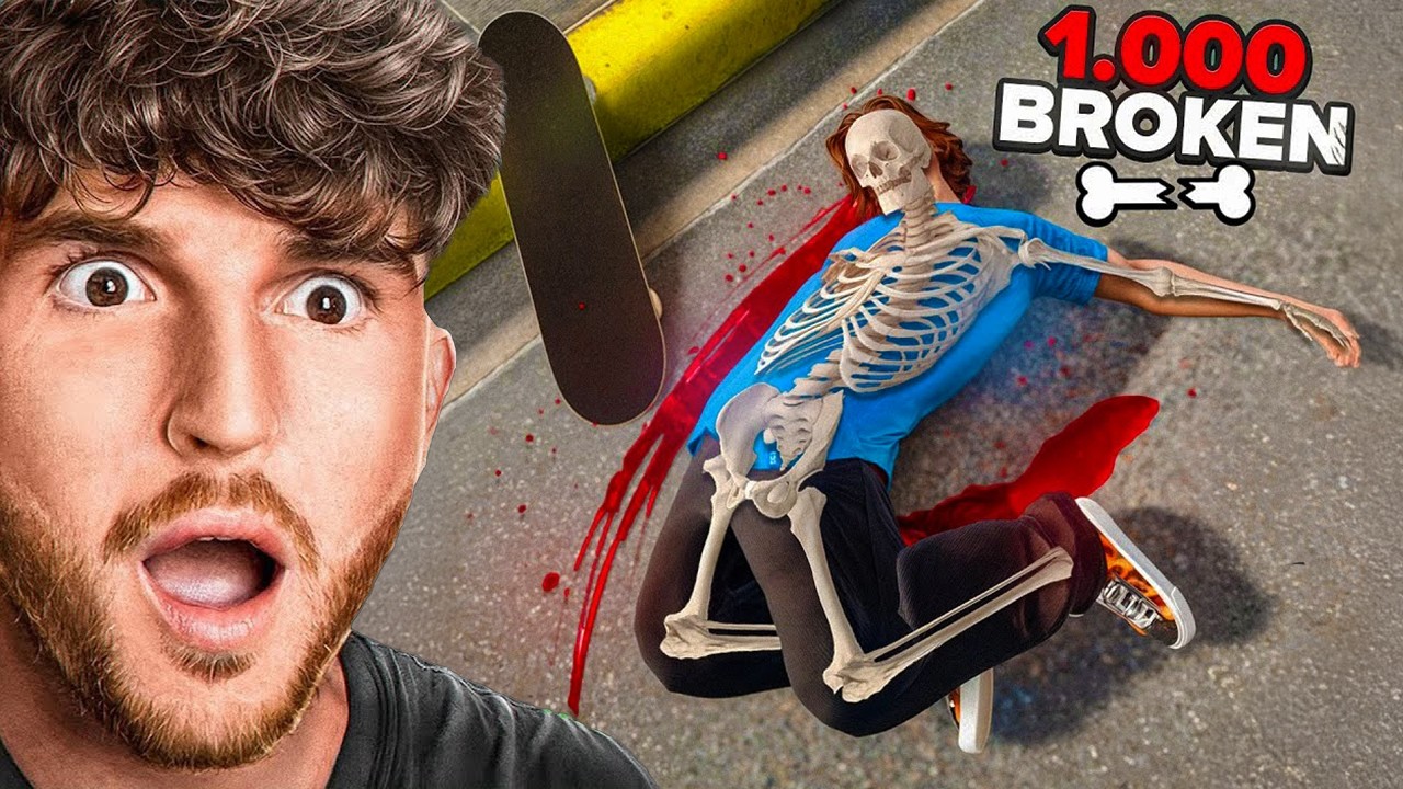 Breaking ALL 1000 BONES As a PRO SKATEBOARDER!