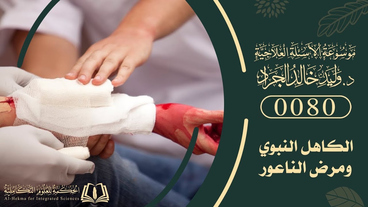 السؤال [80] [6-2]: في التّجربة السورية لمحمد أمين شيخو وحديثهم عن حجامة نقطة الكاهل ...؟