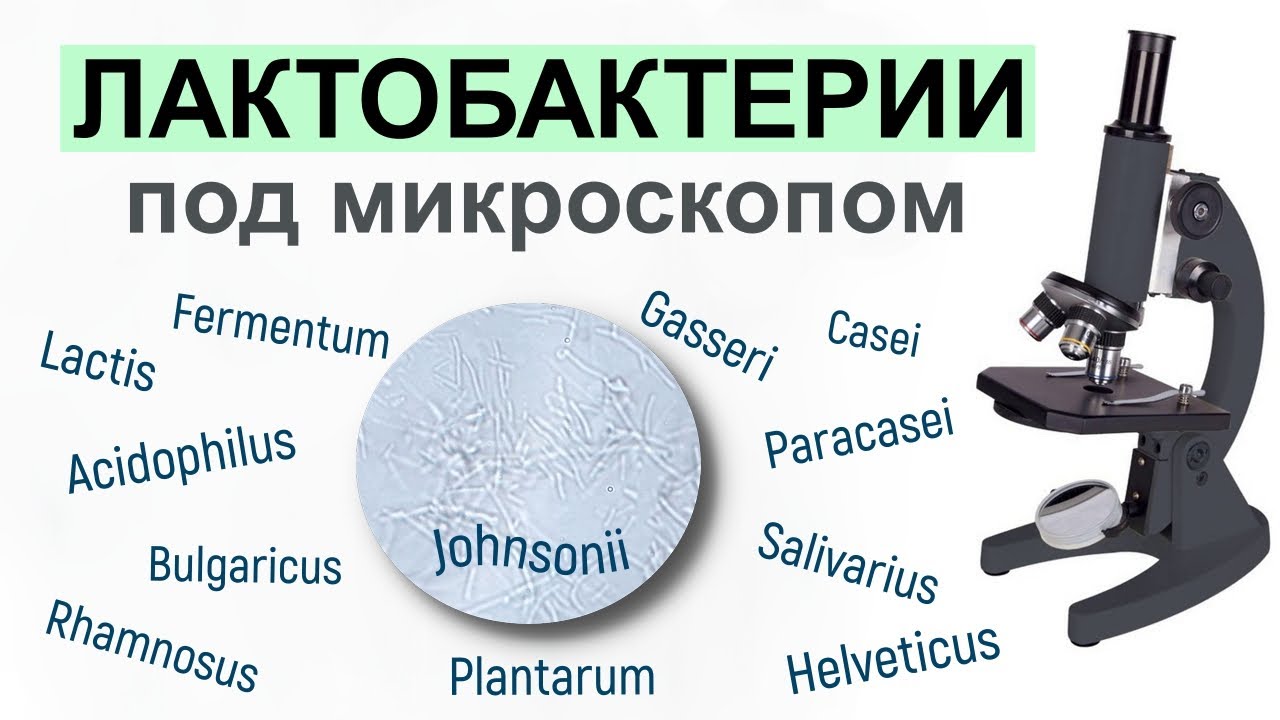 12 видов лактобактерий под микроскопом ! Ощутимая разница )