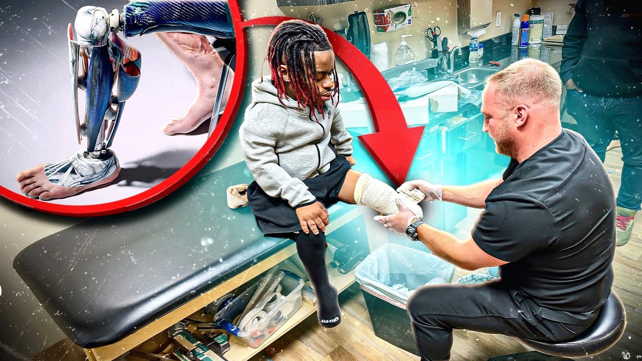 Rich Takes First Step To Getting Prosthetic Leg (Road To Recover)