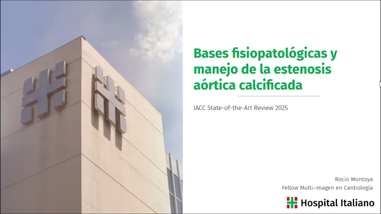 Bases fisiopatológicas y del tratamiento de la estenosis valvular aórtica calcificada