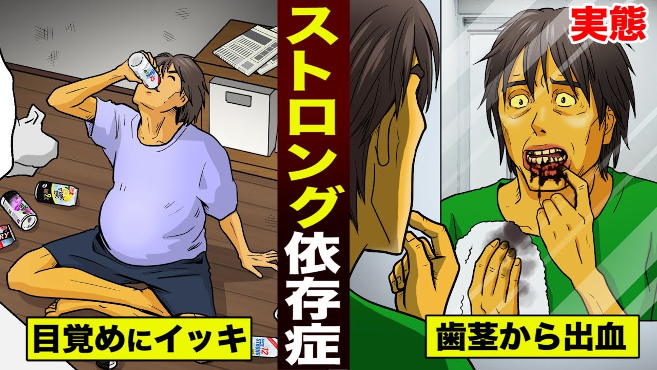 【実話】ストロング酎ハイで&hellip;重度アル中になった男。歯茎から大量出血。
