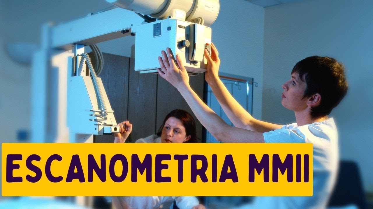 VEJA O QUE SERIA ESCANOMETRIA MMII #RADIOLOGIA