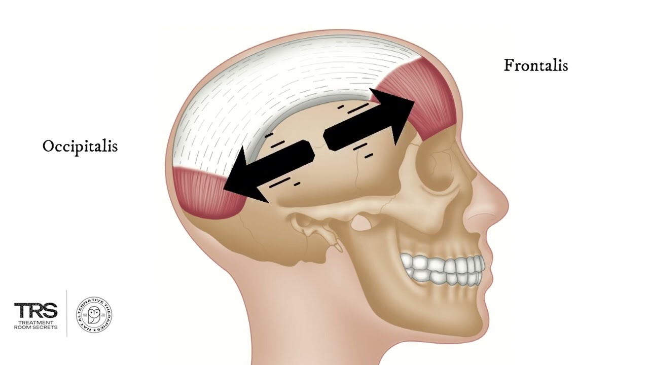 Occipital Muscles - Trigger Point Anatomy
