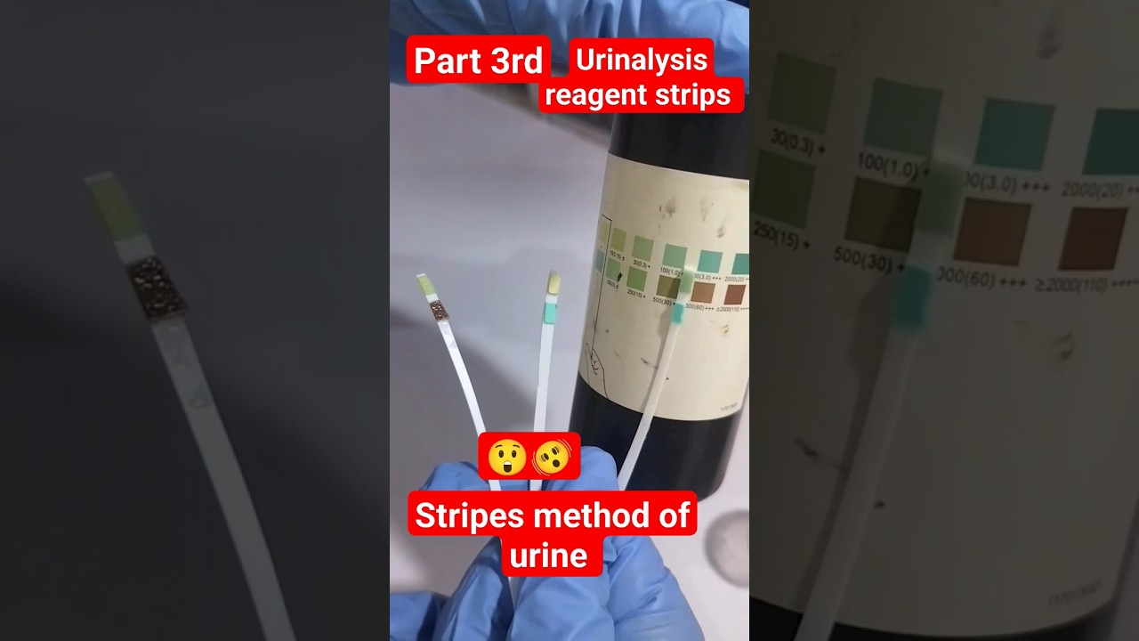 part3rd strips method of urine
