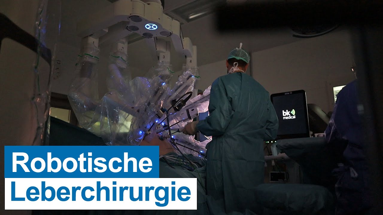 UKM ist Hospitationszentrum für robotische Leberchirurgie