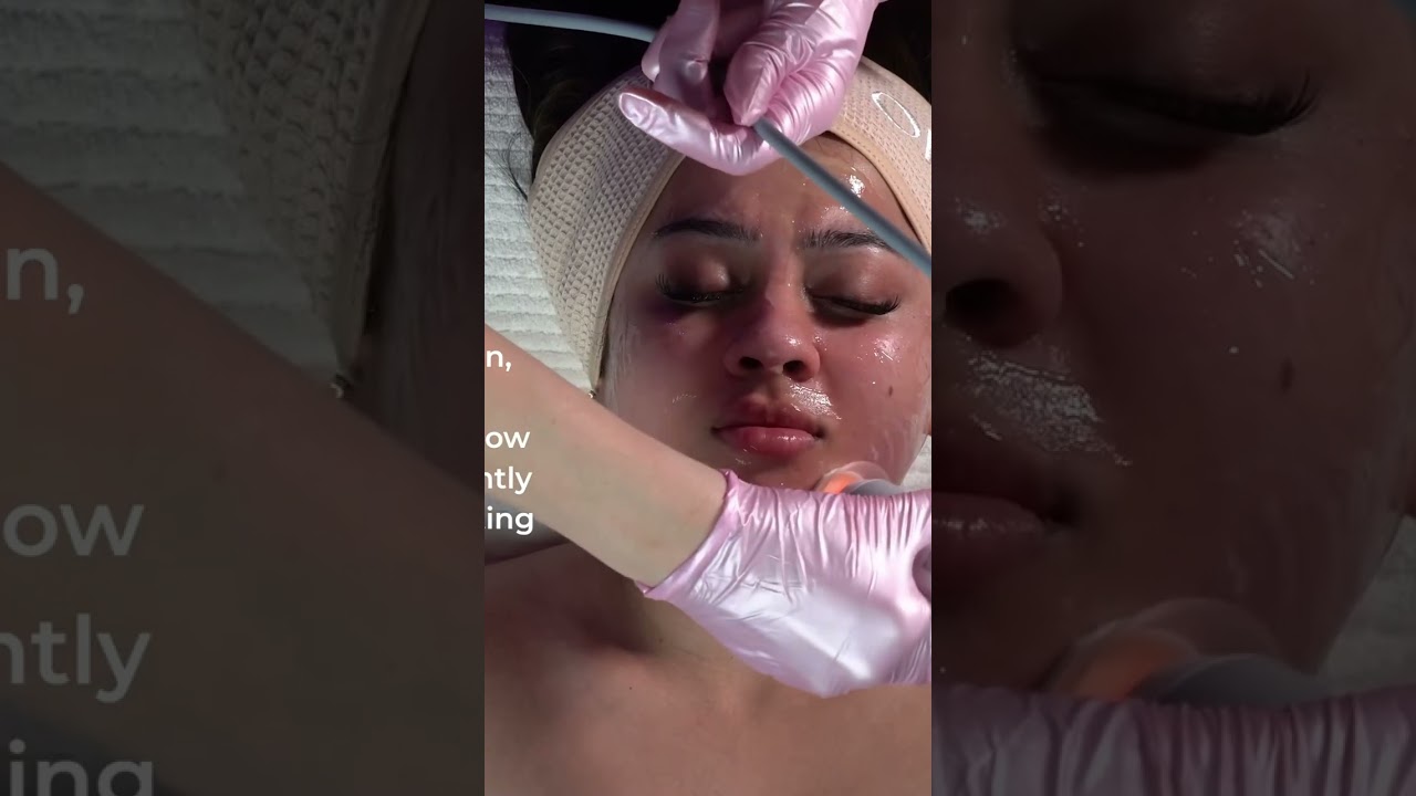 Glow Up Secret: Spa Facial With Alpha-Arbutin Niacinamide! #shorts