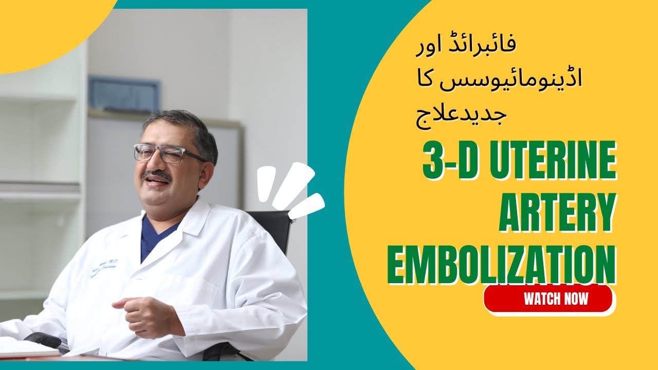 فائبرائڈ اور اڈینومائیوسس کا جدیدعلاج
fibroid embolization