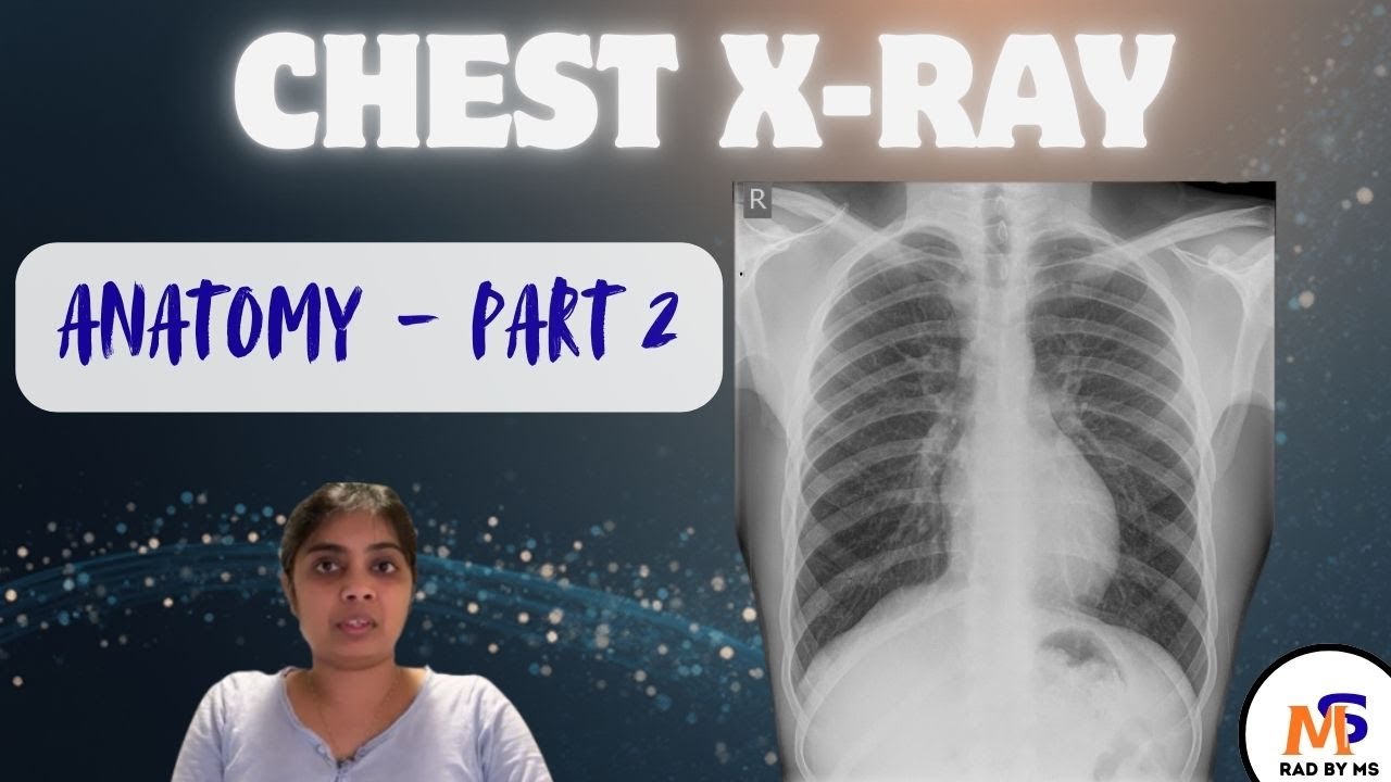 Chest X-Ray Anatomy (Part 2)