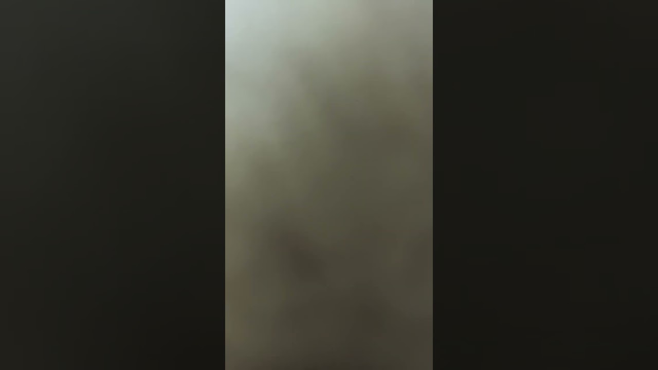 #Dr #CheckUp #Vagina #vaginacleansing #survival #pubic #pubiccleaning #thighs #naked