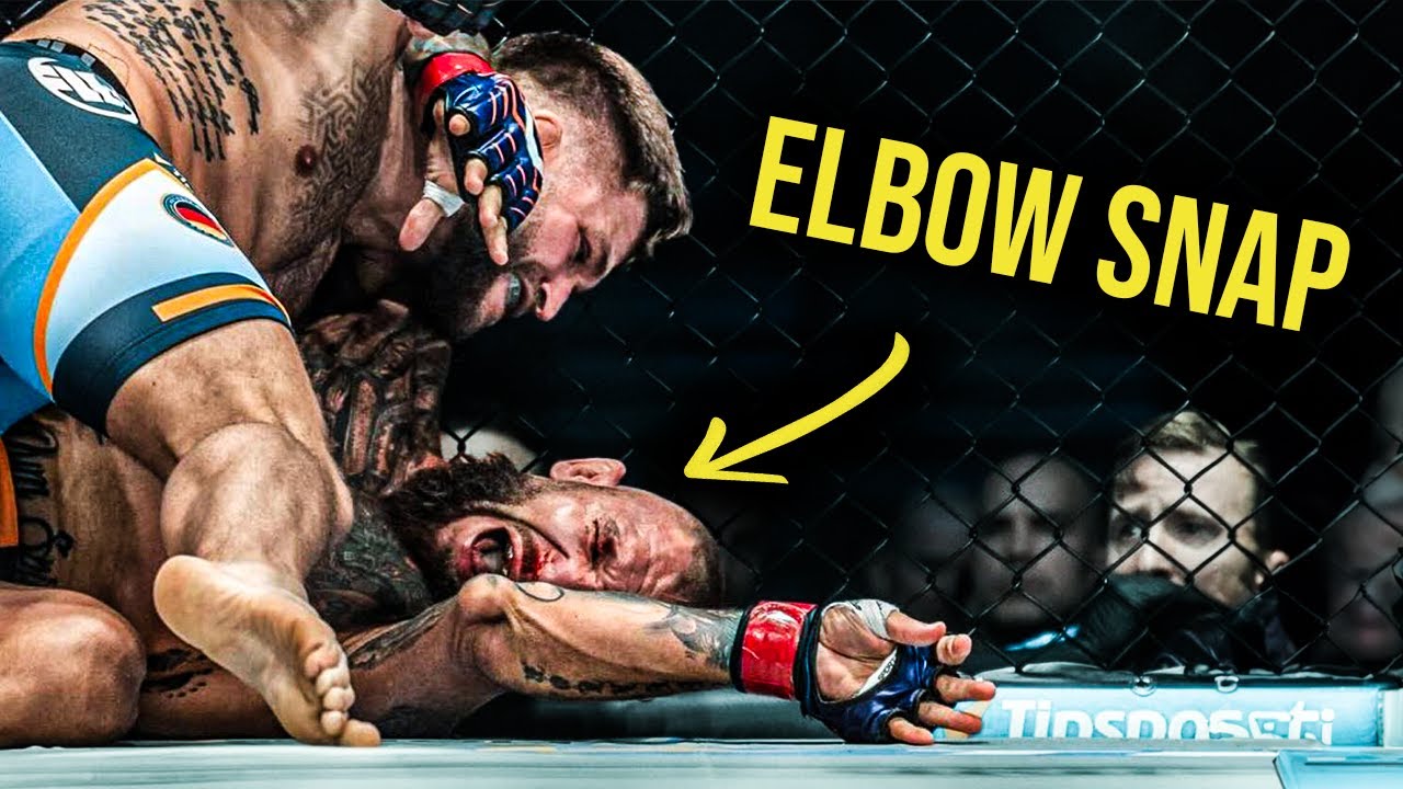 Watch To See An ELBOW POP 🤮😳