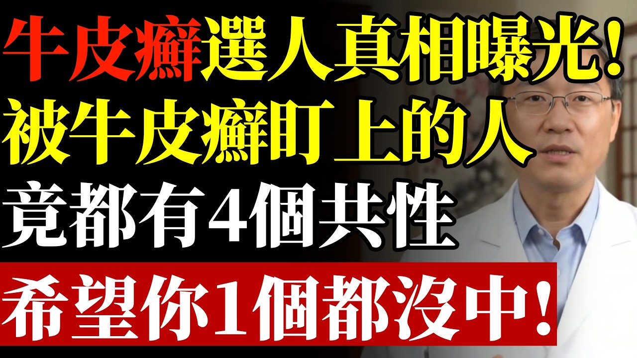 牛皮癬不會平白無故找上門！醫生強調：得牛皮癬的人，多半有5個共性#康醫師 #牛皮癬 #乾癬 #銀屑病 #免疫系統失調 #發炎體質 #關節變形 #保護皮膚 #乾癬性關節炎 #早知早受益
