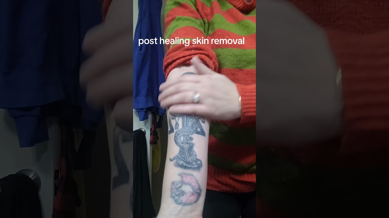 Healing Better Than Expected 