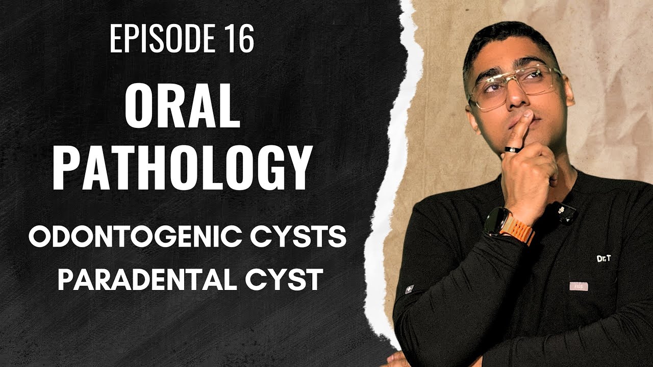 Dental Digest | Oral Pathology | Episode 16 – Paradental Cyst